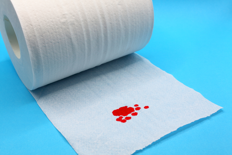 血便が出た(鮮血、痛みあり・痛みなし)