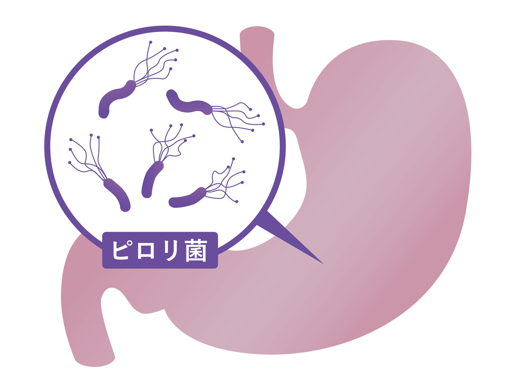 ピロリ菌(ヘリコバクター・ピロリ菌)とは