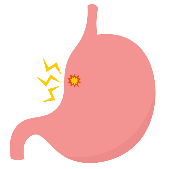 胃潰瘍とは